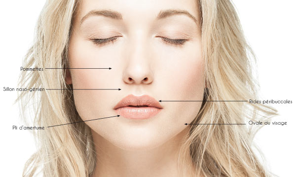 Parties du visage qui peuvent être traitées à l'acide hyaluronique